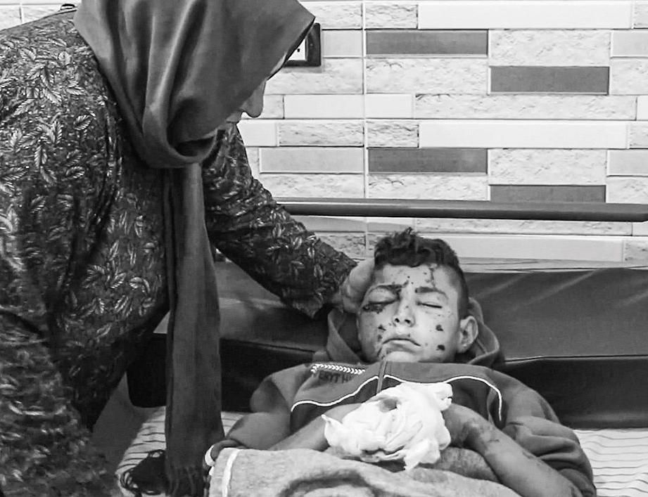AVC Syrien Bild verletzter Junge